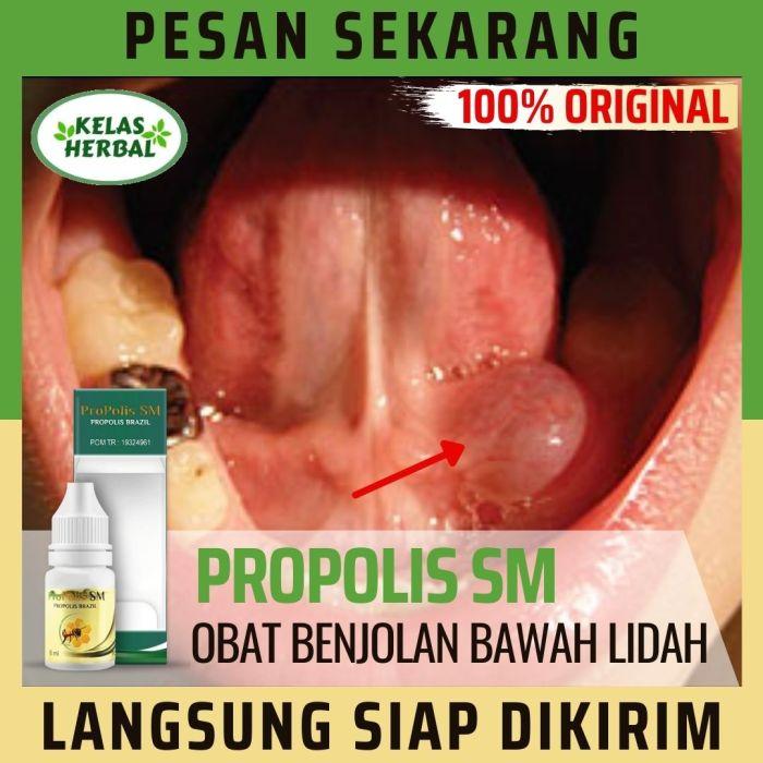 116a25c1470a01e