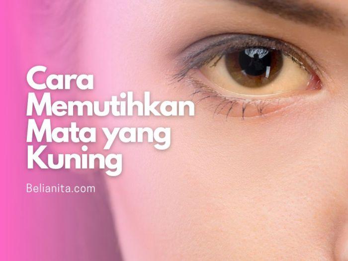 Cara Membuat Mata Kuning Kembali Putih: Panduan Langkah demi Langkah 1 116a25c749ea477