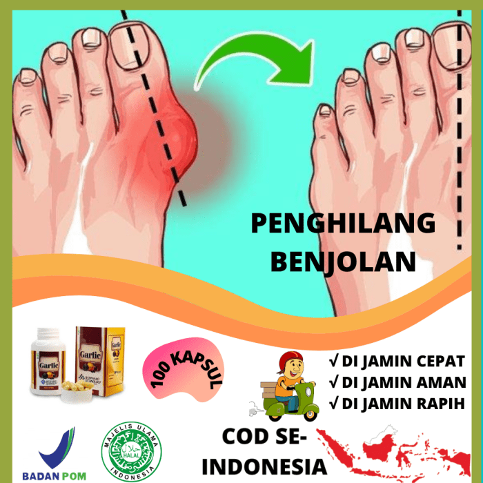 Cara Mengobati Benjolan di Paha Kanan: Panduan Lengkap 1 116a25c8b6dbc97