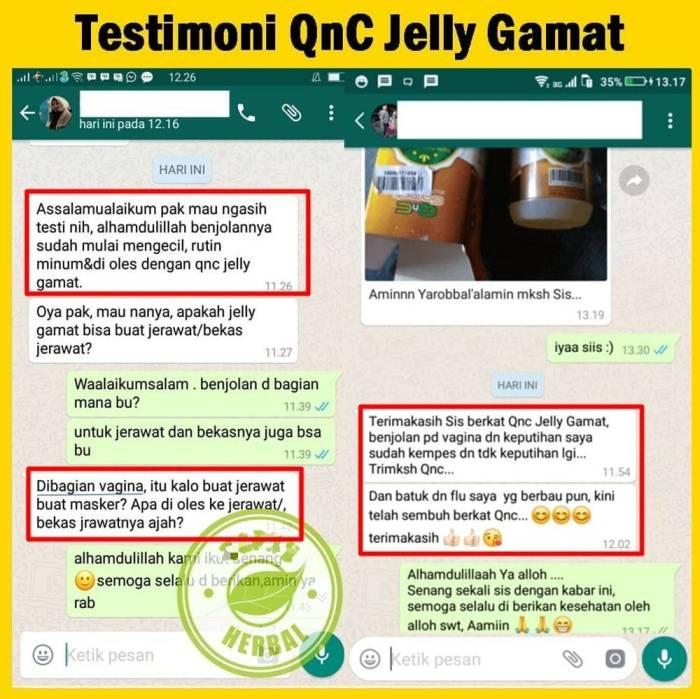 Cara Mengobati Benjolan di Paha Kanan: Panduan Lengkap 3 116a25c8b7cabe7