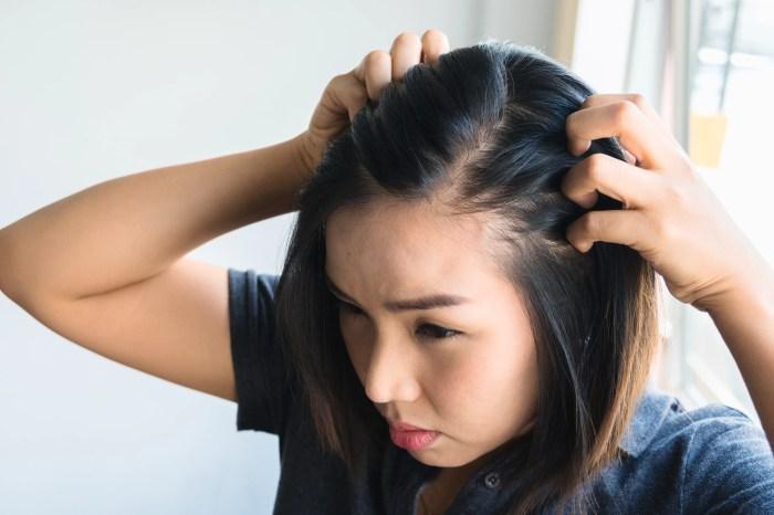 Cara Agar Rambut Tidak Cepat Lepek 2 116a25ca8f00d17