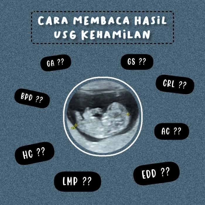 Cara Membaca Hasil HSG Panduan Lengkap dan Mudah Dipahami 3 116a25cbcd32699